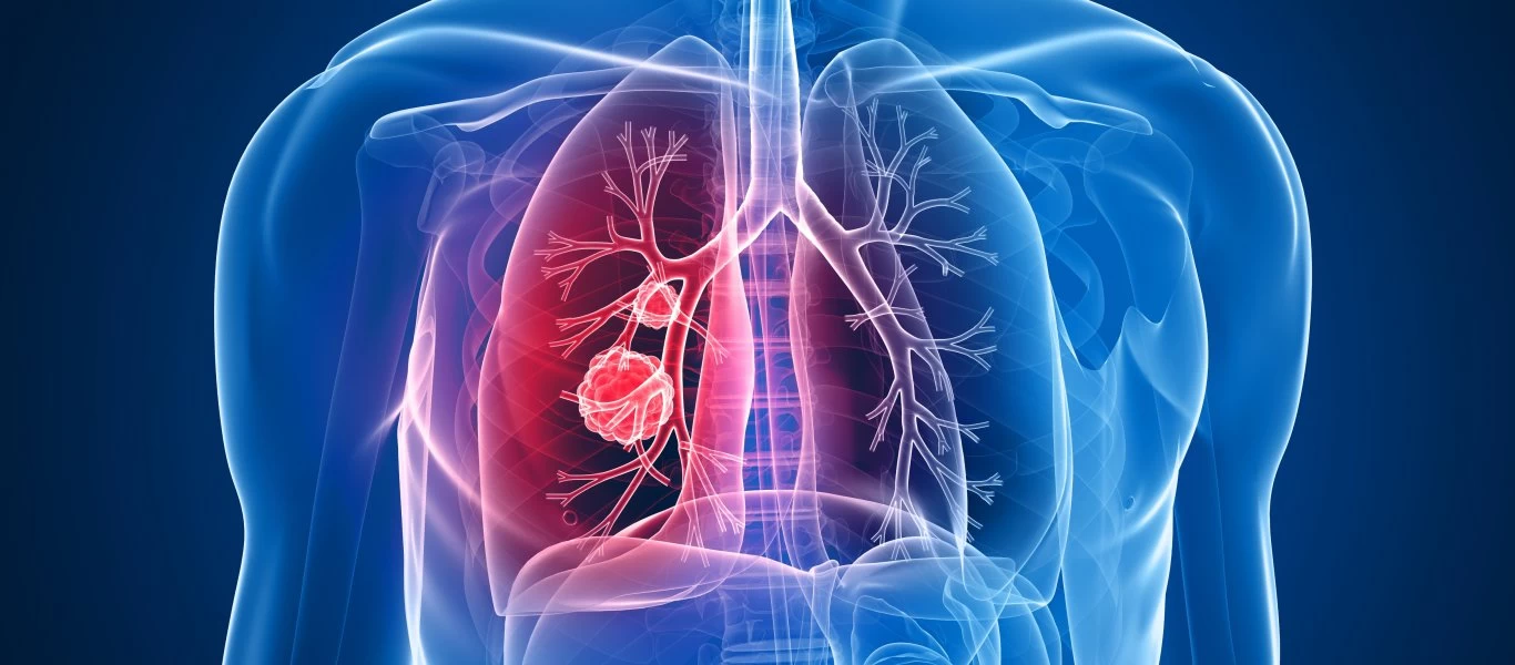 Αυτές είναι οι 6+1 τροφές «φάρμακο» για τους πνεύμονες